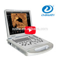 DW-C60plus portátil 3D 4D color doppler máquina de ultrasonido con aprobación CE